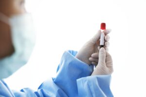 doctor-holding-blood-test-tube-min